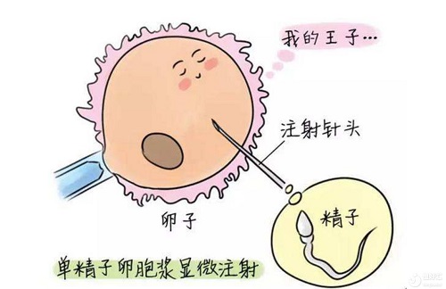 試管嬰兒移植后還能不能上班？